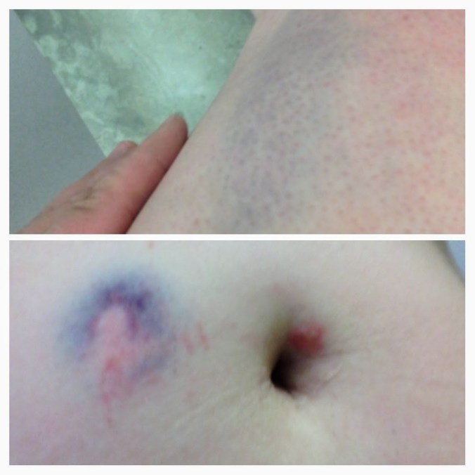 20170813_175919-COLLAGE